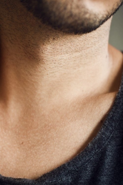 Лазерная эпиляция у мужчин на шее