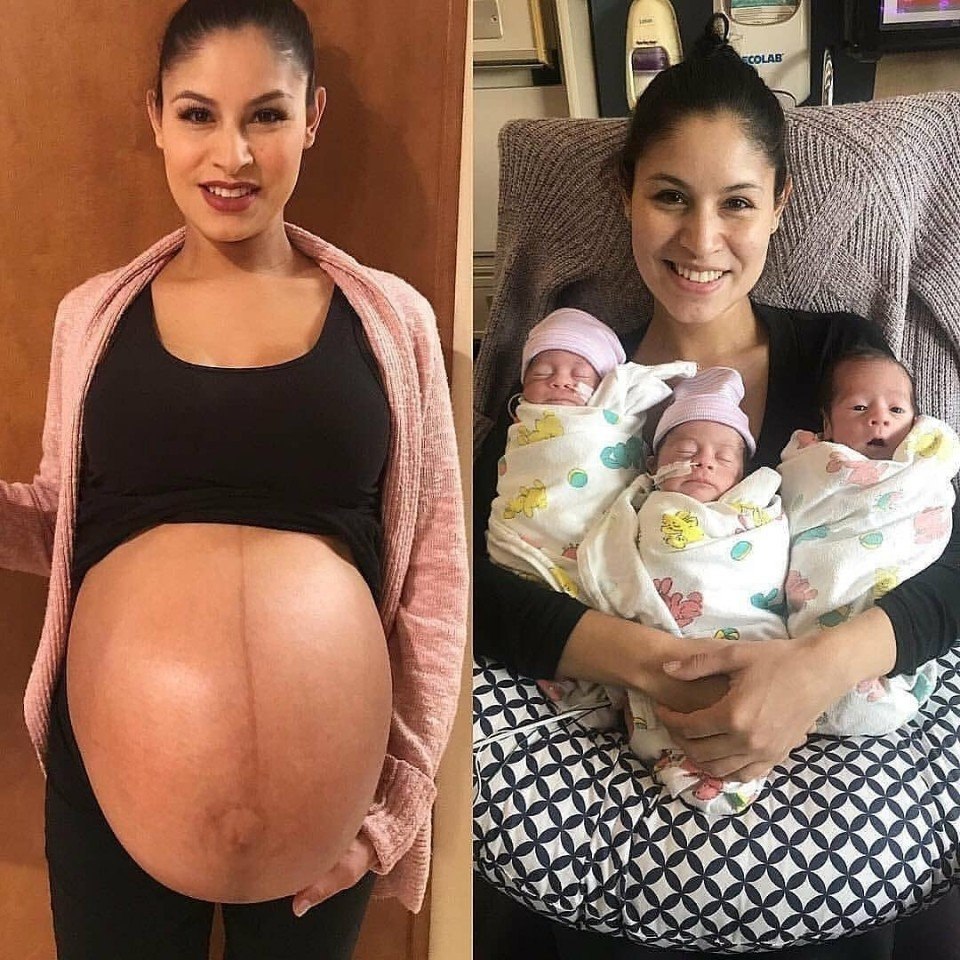 Женщина беременная двойней