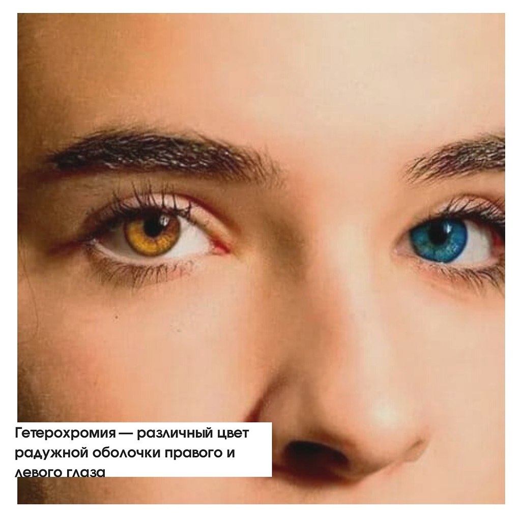We Need The Eggs Olhos impressionantes, Olhos maravilhosos, Olhos de cores difer