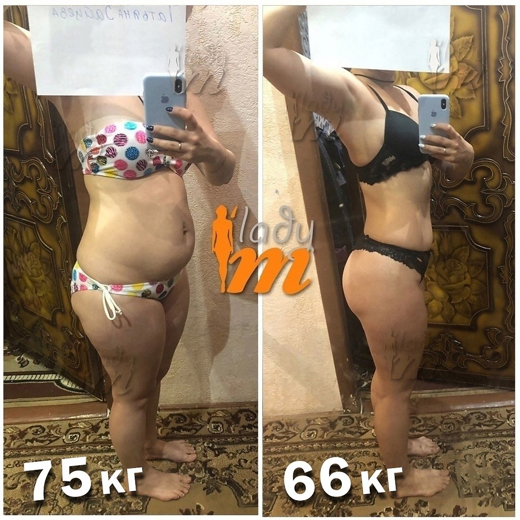 Как убрать торчащий низ живота без спорта