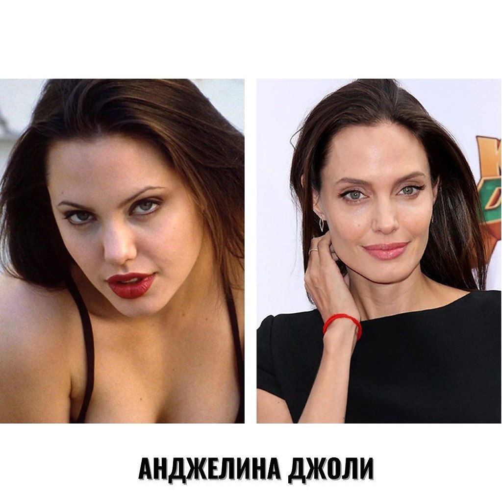 Анжелина Джоли до и после пластики