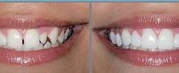 diastema do.... i posle luminera..)) �� ������� �.....MY WORKS.....�