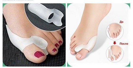 ФИКСАТОР БОЛЬШОГО ПАЛЬЦА VALGUS PRO – ОДНО РЕШЕНИЕ ТРЕХ ПРОБЛЕМ.3АКАЗАТЬ МОЖНО ТУТ: ...