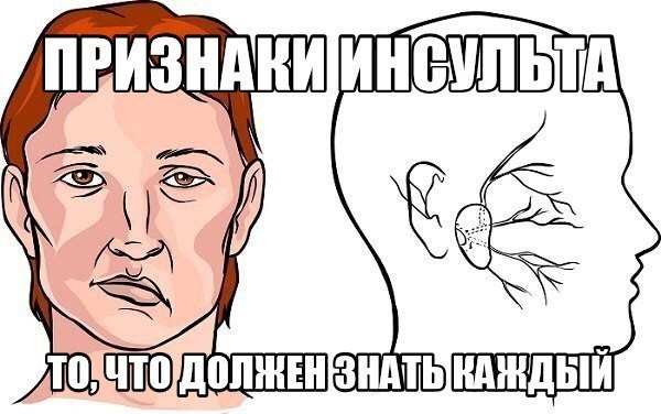 Признаки инсульта.То, что должен знать каждый!Во время пикника девушка споткнулась и упала. Ей ...