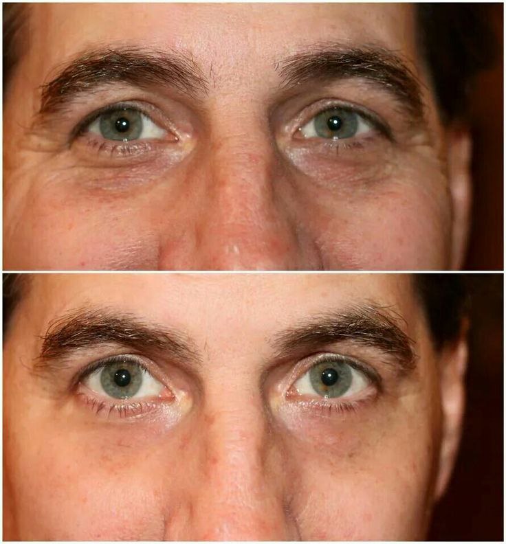    ! -15   2 ! https://fotostrana.ru/away?to=/sl/96w  ... - 2