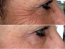    ! -15   2 ! https://fotostrana.ru/away?to=/sl/96w  ... - 3