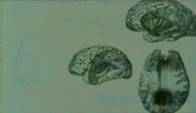   .(Unique features of the brain)     ... - 3