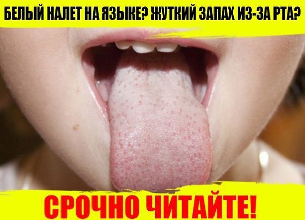 Вонь изо рта НЕ из-за больных зубов! .Дыхание станет свежим НАВСЕГДА если утром в чай добавить 2 ...