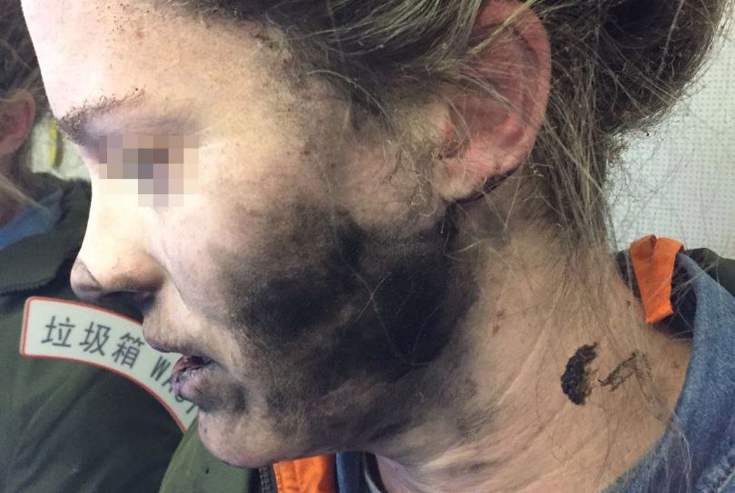 Беспроводные наушники взорвались на голове девушки во время авиаперелёта.Похоже, что в самом ...