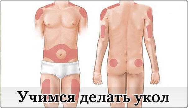 КАК СДЕЛАТЬ УКОЛ ВНУТРИМЫШЕЧНО. 1.Вымойте руки, а затем протрите их спиртом. 2.Подготовьте ...