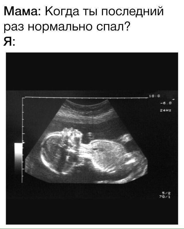    :-) - 29  2017  00:35
