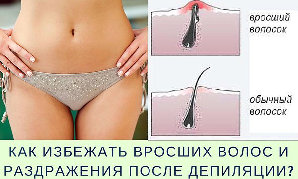 Ухаживающие за собой женщины знают, как непросто иметь гладкую и чистую кожу. Больше всего хлопот ...