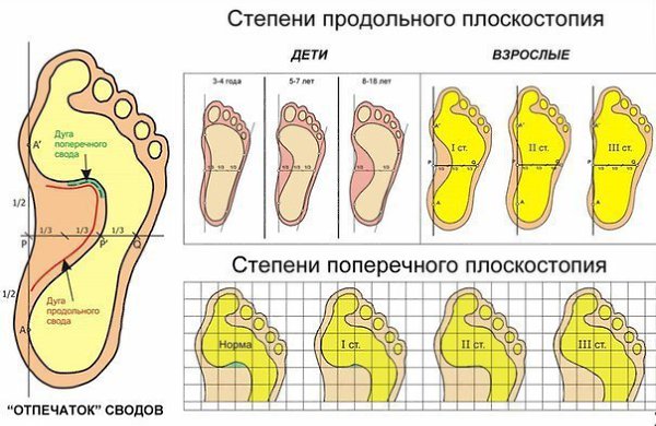 УПРАЖНЕНИЯ ДЛЯ СТОП! Свод стопы формируется у детей 3–4 лет. Однако относительная слабость мышц и ... - 3