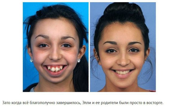 Хирург поправил ей форму челюсти. Просто невероятное преображение. - 4