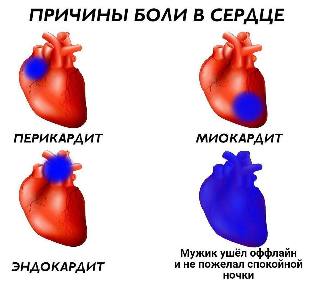    - 14  2017  03:22