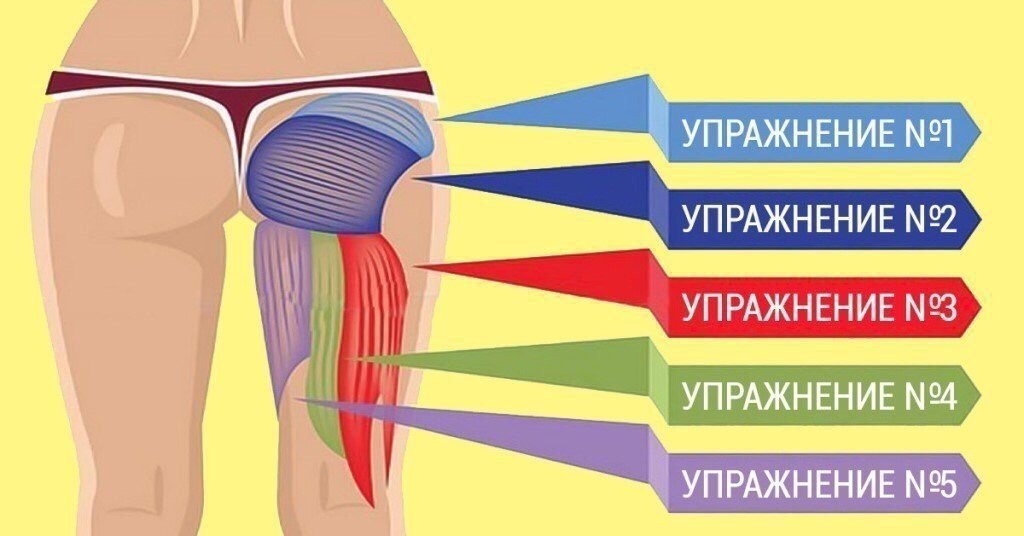 Тейпирование ягодиц схема