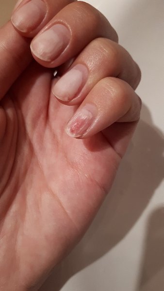 #Истории@modnailru.Всем привет!Начитавшись ужасных записей, решила поделиться собственным опытом для ... - 2