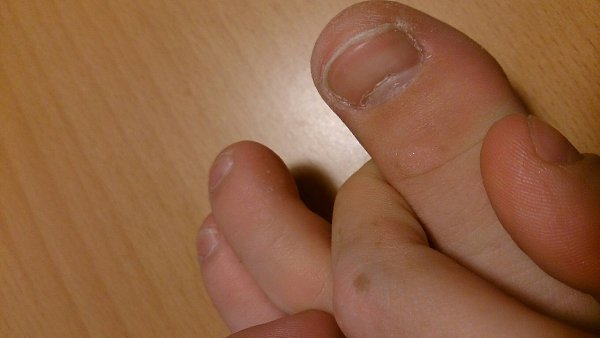 #Истории@modnailru.Девочки,помогите Ногти не ровные, волнистые, бугорками Не желтеют, не болят ...