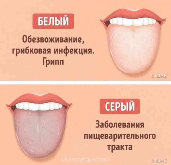 Как определить заболевание по цвету языка. На заметку - 3