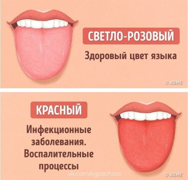 Как определить заболевание по цвету языка. На заметку - 5