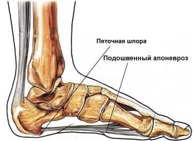 ЛЕЧЕНИЕ ПЯТОЧНОЙ ШПОРЫ С ПОМОЩЬЮ НАРОДНЫХ СРЕДСТВ.Народный рецепт №1: лечение картофелем Возьмите ...