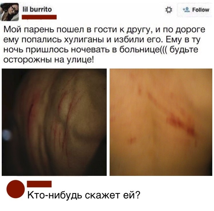 -  ?!)