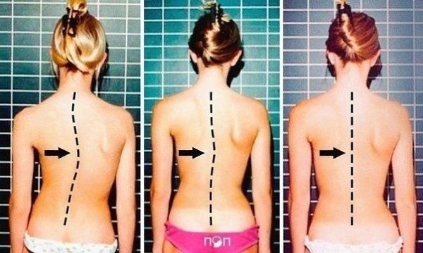 pae oope ype  ae c! y  ope