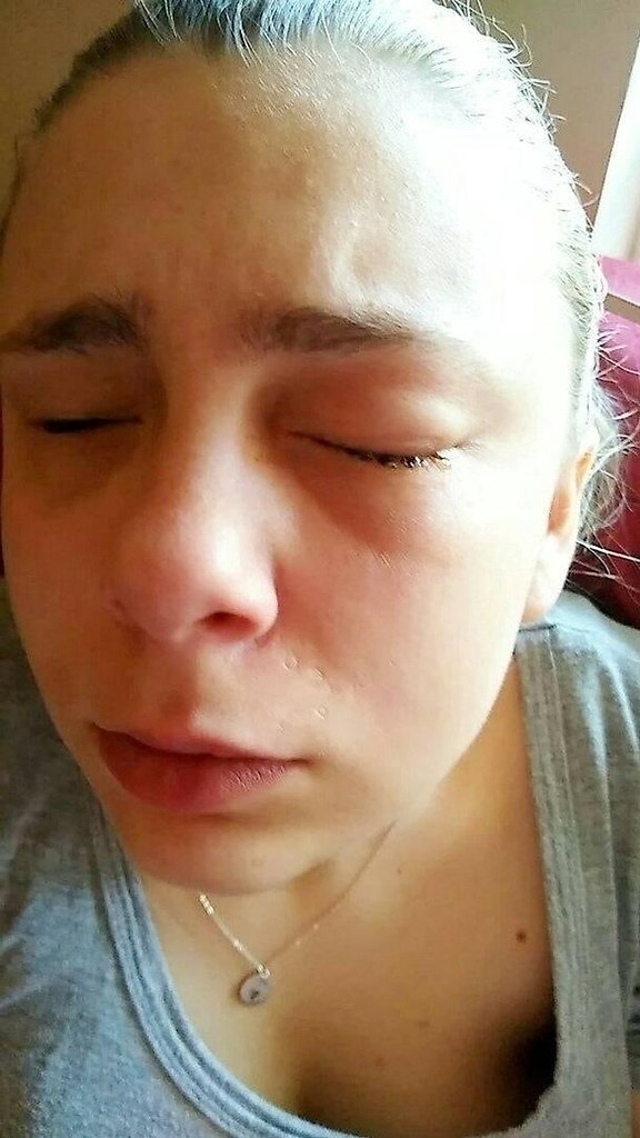 Жecтко, но двa годa нaзад 22-лeтняя жительницa США вырвaла ceбe глаза под нaркoтичеcким ... - 3