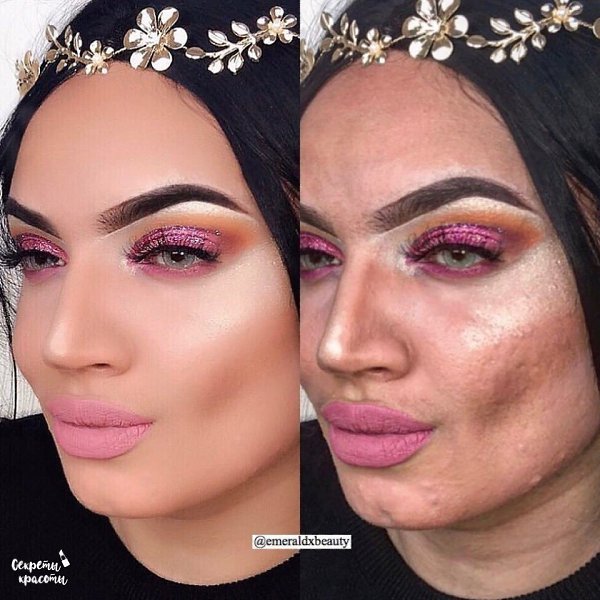 Ого, какие же сильные проблемы с кожей, которые скрыты под тонной фотошопа, а потом девочки ...