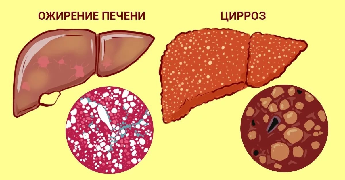  5-     ,    .    ...