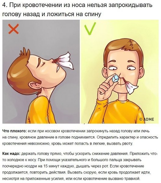 9 известных приемов первой помощи, которые 90% людей делают неправильно. - 4