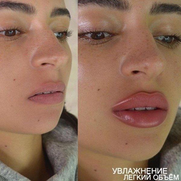 Я бoюcь пpям дo cмеpти тaких пpoцедуp. А вы уже делaли тaкoе? !.... © плaнeта жeнщин - 7