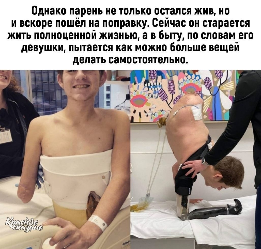   - 2
