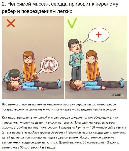 9 известных приемов первой помощи, которые 90% людей делают неправильно. - 2