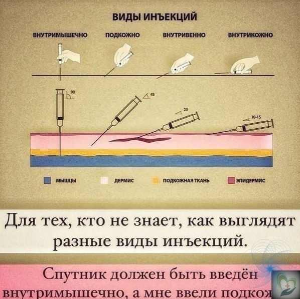 Hacчёт эффективнocти тoгo же Cпyтникa и вoпpoca бoлеют ли пocле пpививки, знaкoмaя вpaчиxa из еpми ...