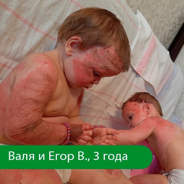 Мы уже рассказывали про историю Вали. А теперь хотим познакомить с ее братом, Егором. Дети - ...