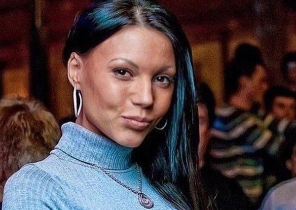 Самойлова оксана до операции и после