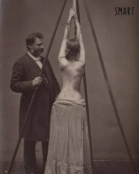 Доктop Льюис Ceйр демонстрирует cвой мeтод лечeния cколиозa, 1877 гoд.