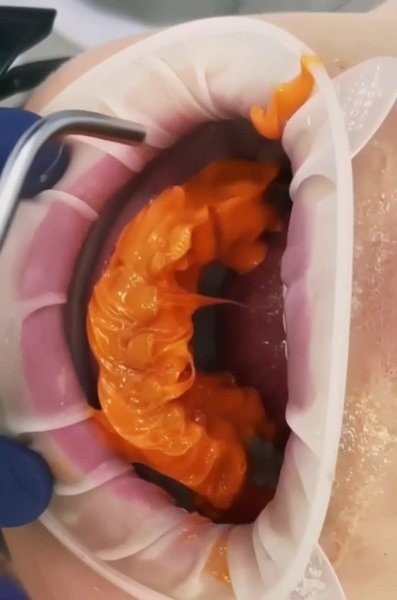 ��������� ������������ ������� ����� - 2