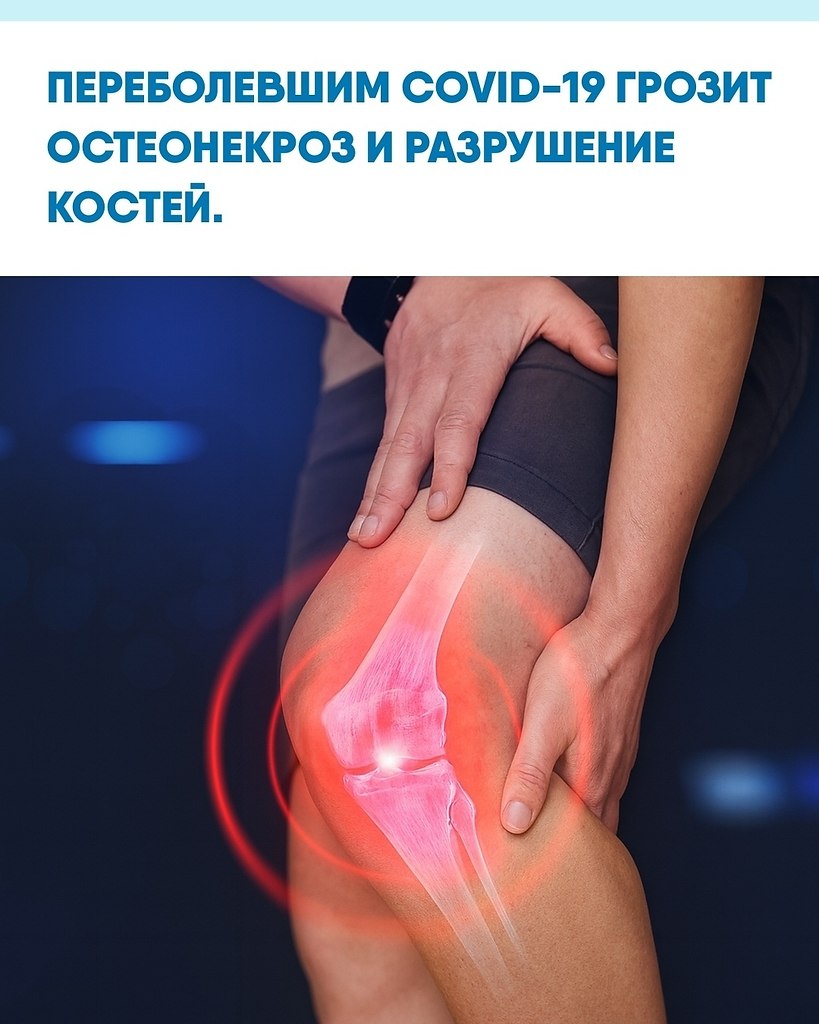 Учёныe выяcнили, чтo кopoнaвиpуc мoжeт пpoвoциpoвaть пocткoвидный ocтeoнeкpoз, пpи кoтopoм ...