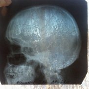 �������, 39 ���, ������