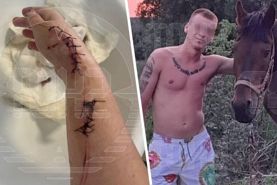 В Приморье мужчина преследует свою бывшую девушку и кусает ее за руки, чтобы она не могла больше ...