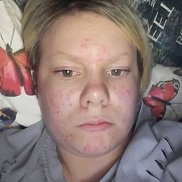 , 18 , 