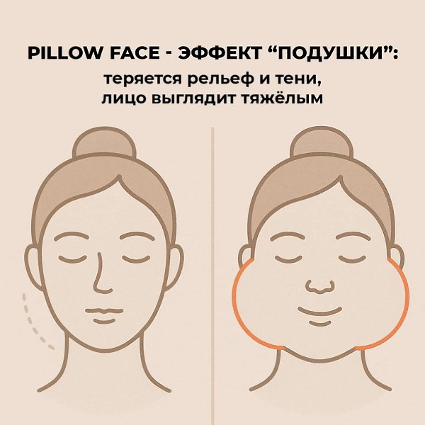 Лицо как подушка - отёки, сглаженные черты, тяжёлый взгляд. Это случается, когда филлеры используют ... - 4