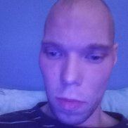 �������, 34 ����, ������