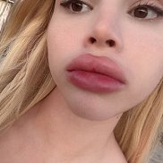 ��������, 24 ����, ������