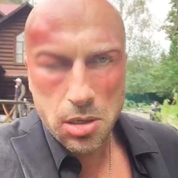 Нагиев подрался, на этот раз все серьезно.Вчера на съёмочной площадке произошёл инцидент, который ...