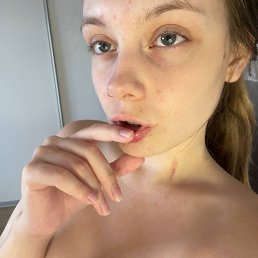 , 17, 