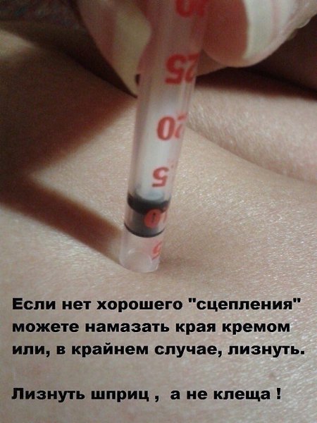 Это важно! Скоро клещи активизируются. Сохраните, не пожалеете! Как безопасно и целиком удалить ... - 5