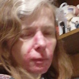 �������, ������, 44 ����